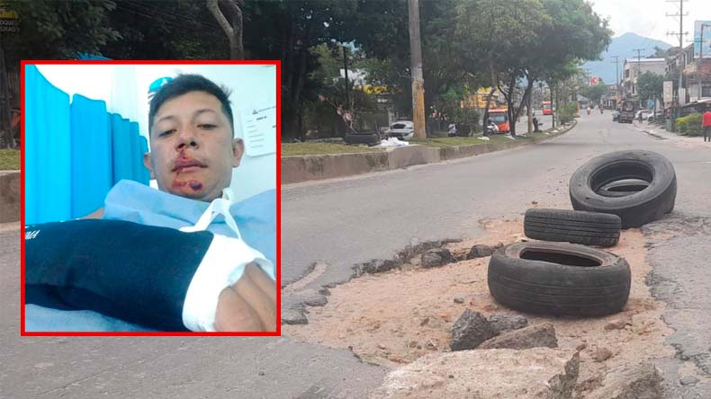 Herido hueco del sur