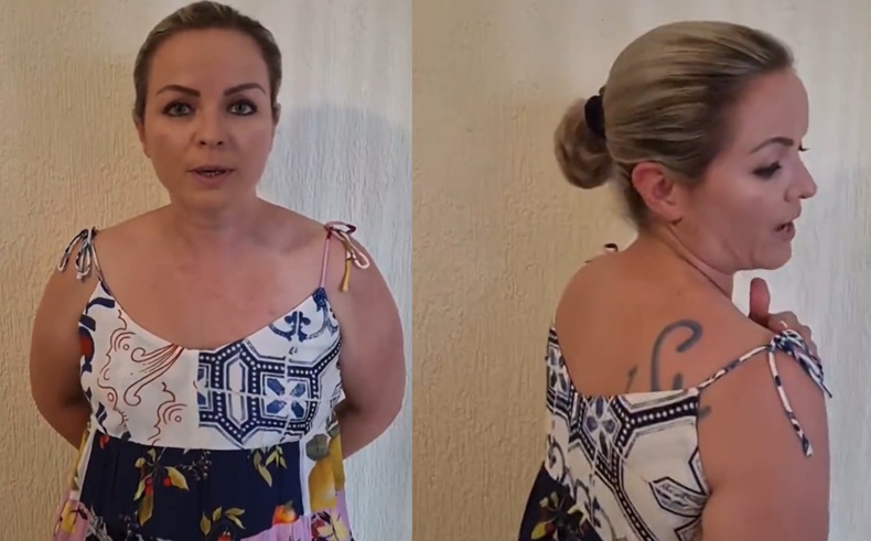 mujer quemada