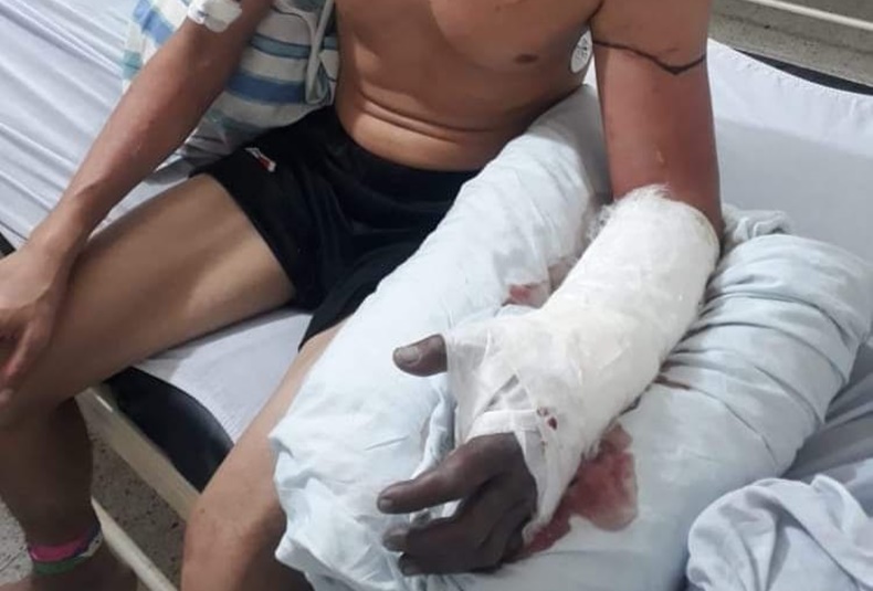 adentro brazo